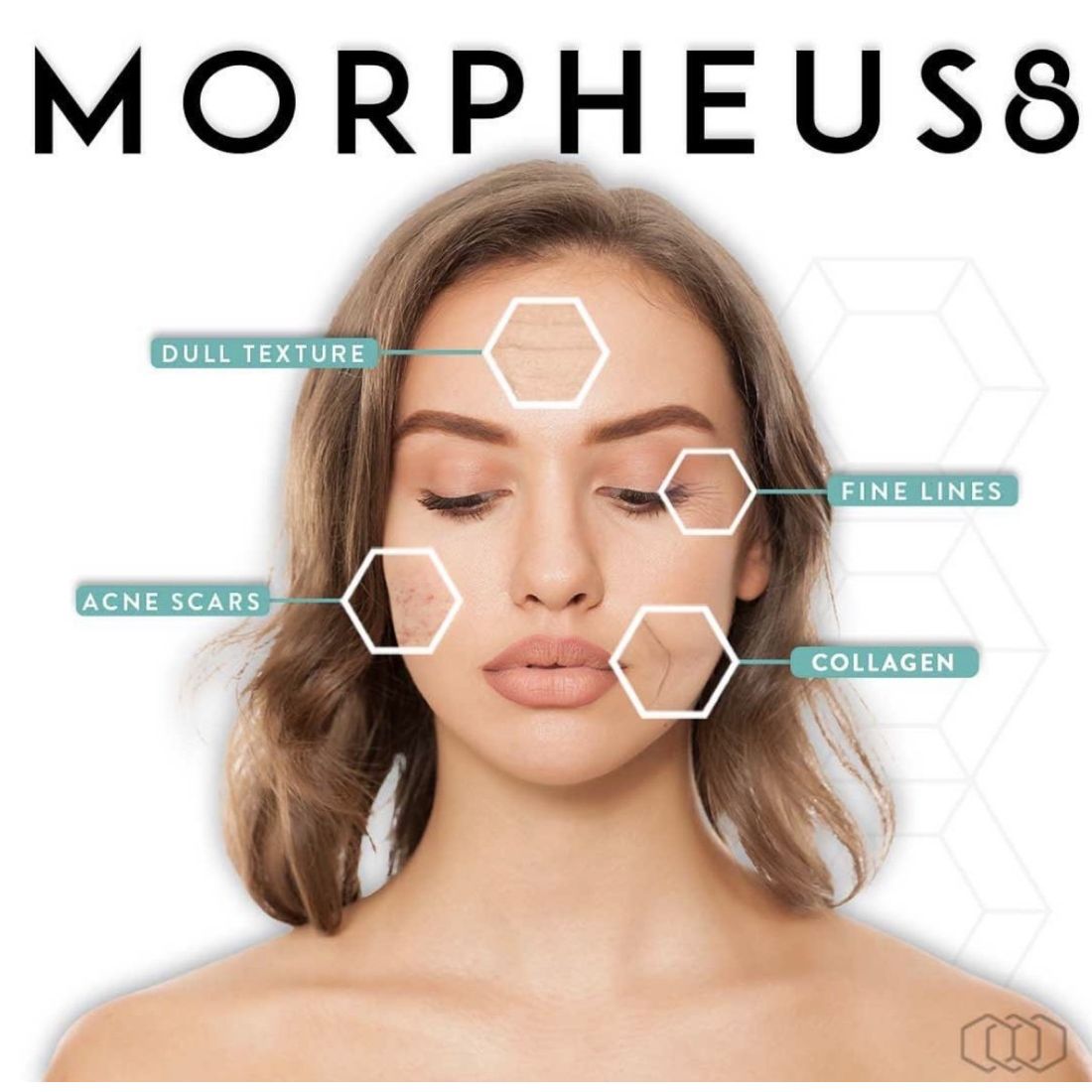 The Benefits Of Microneedling